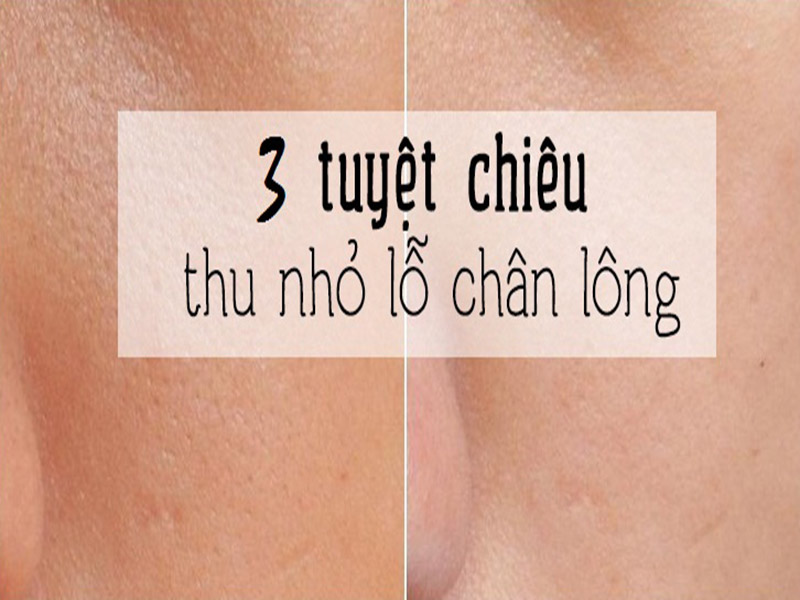 9 cách thu nhỏ lỗ chân lông tự nhiên nhanh, hiệu quả • Hello Bacsi