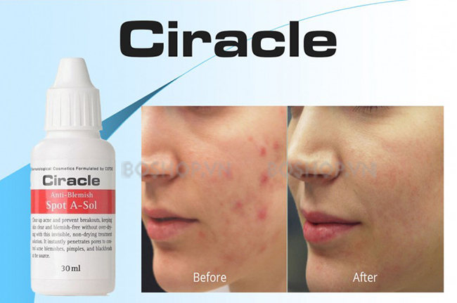 cham-mun-ciracle-anti-blemish-spot-a-sol-30ml-boshop-6.jpg