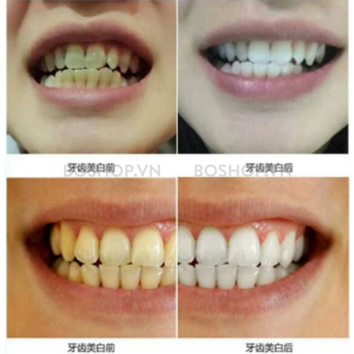 kem-danh-rang-than-tre-zhu-zong-guan-160g-boshop-5.jpg