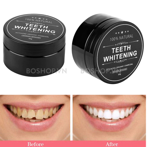 bot-than-hoat-tinh-danh-trang-rang-teeth-whitening-boshop-5.jpg