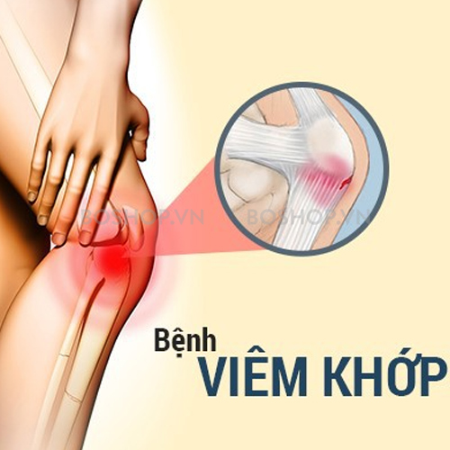 bo-xuong-khop-blackmores-glucosamine-1000mg-300-vien-boshop-3.jpg