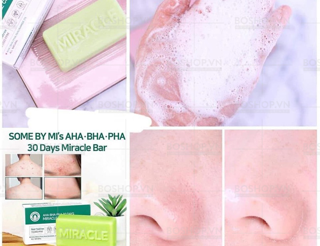 xa-phong-cho-da-mun-some-by-mi-miracle-cleansing-bar-106g-boshop-3-jpg