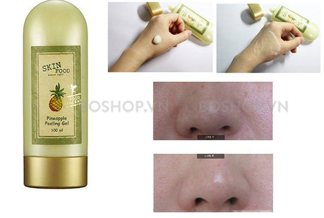 tay-da-chet-skinfood-pineapple-peeling-gel-100ml-nuoi-duong-lan-da-rang-ro