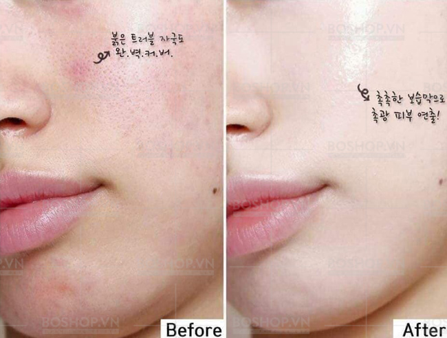 mat-na-giay-innisfree-bija-cica-mask-20ml-boshop-6-jpg