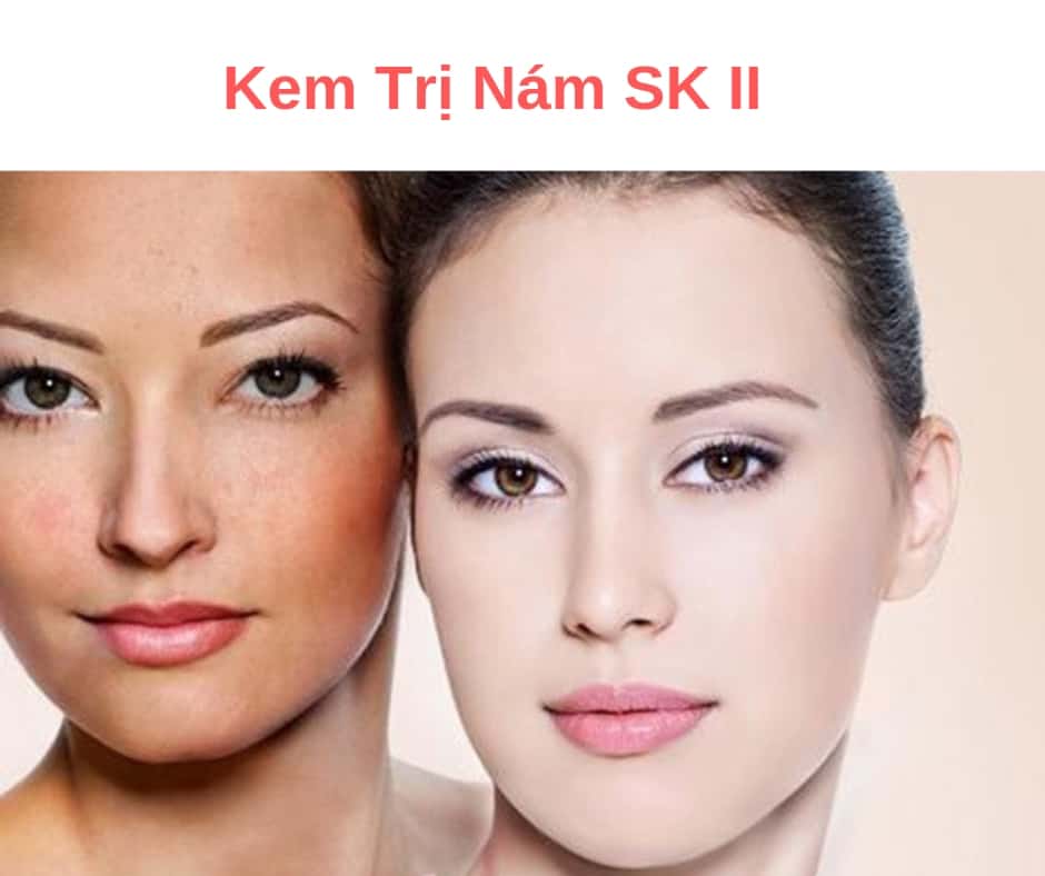 da-nam-se-trang-hong-min-mang-sau-khi-su-dung-sk-ii-tai-nha