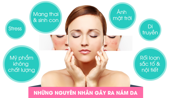 nguyen-nhan-khien-lan-da-phu-nu-thay-doi-khi-mang-thai