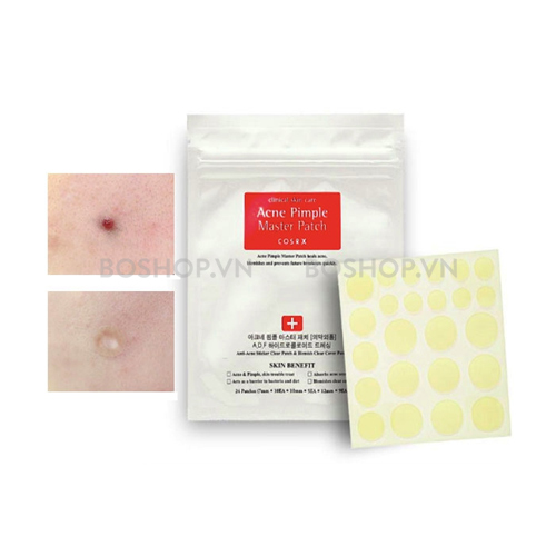 5ddc927c200c8-mieng-dan-mun-cosrx-acne-pimple-24-patches.jpg