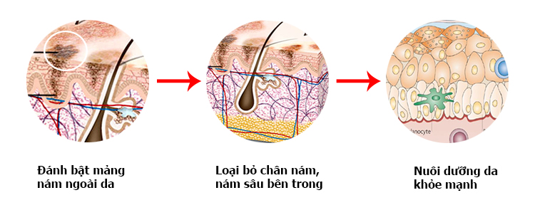 chon-dung-nhung-loai-kem-loai-bo-nam-sau-tu-ben-trong-jpg