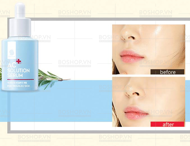 serum-duong-da-mun-g9skin-ac-solution-30ml-boshop-6-jpg