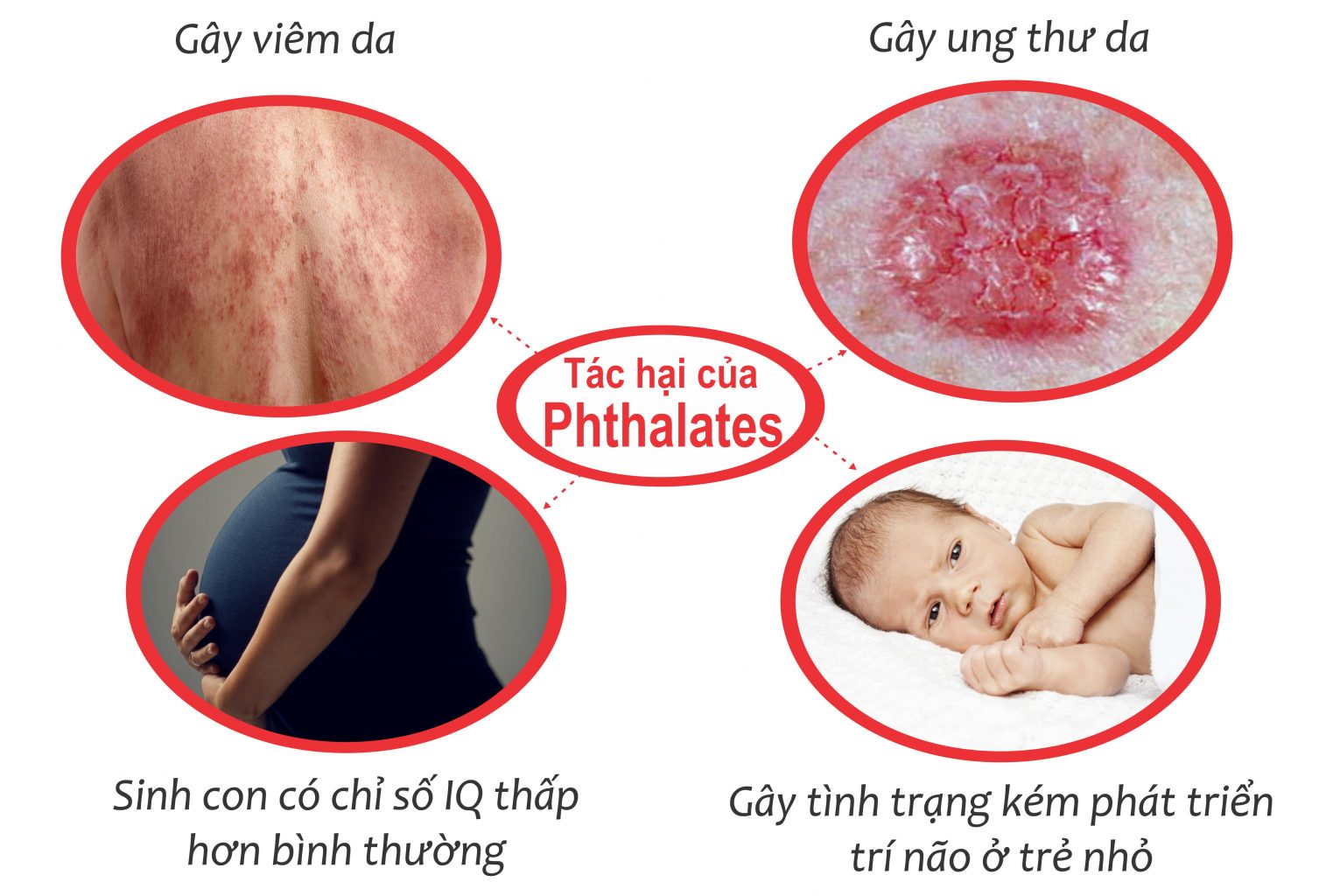 tac-hai-cua-phthalates-co-trong-son-duong-anh-huong-nghiem-trong-den-thai-nhi-jpg