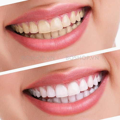 kem-danh-rang-crest-advanced-triple-whitening-158g-boshop-4-jpg