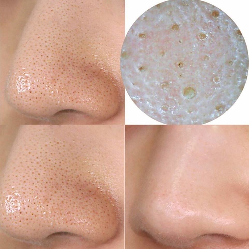 su-that-mat-na-innisfree-super-volcanic-pore-clay-mask-2x-co-tot-khong-boshop-2-jpg