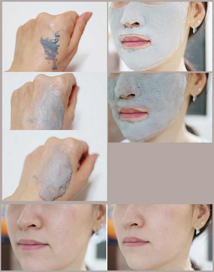 hieu-qua-sau-khi-dung-mat-na-elizavecca-milky-piggy-carbonated-bubble-clay-mask-jpg