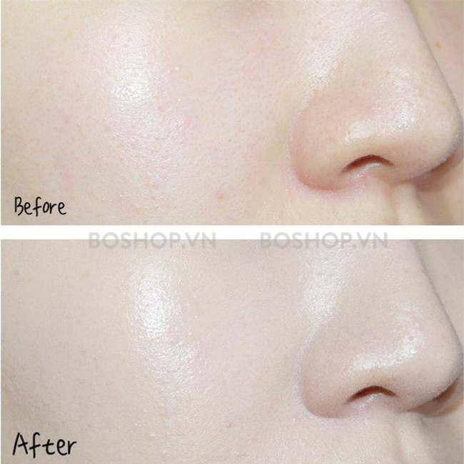 tinh-chat-cap-am-neutrogena-hydro-boost-vitamin-e-hyaluronic-acid-serum-30ml-boshop-9-jpg