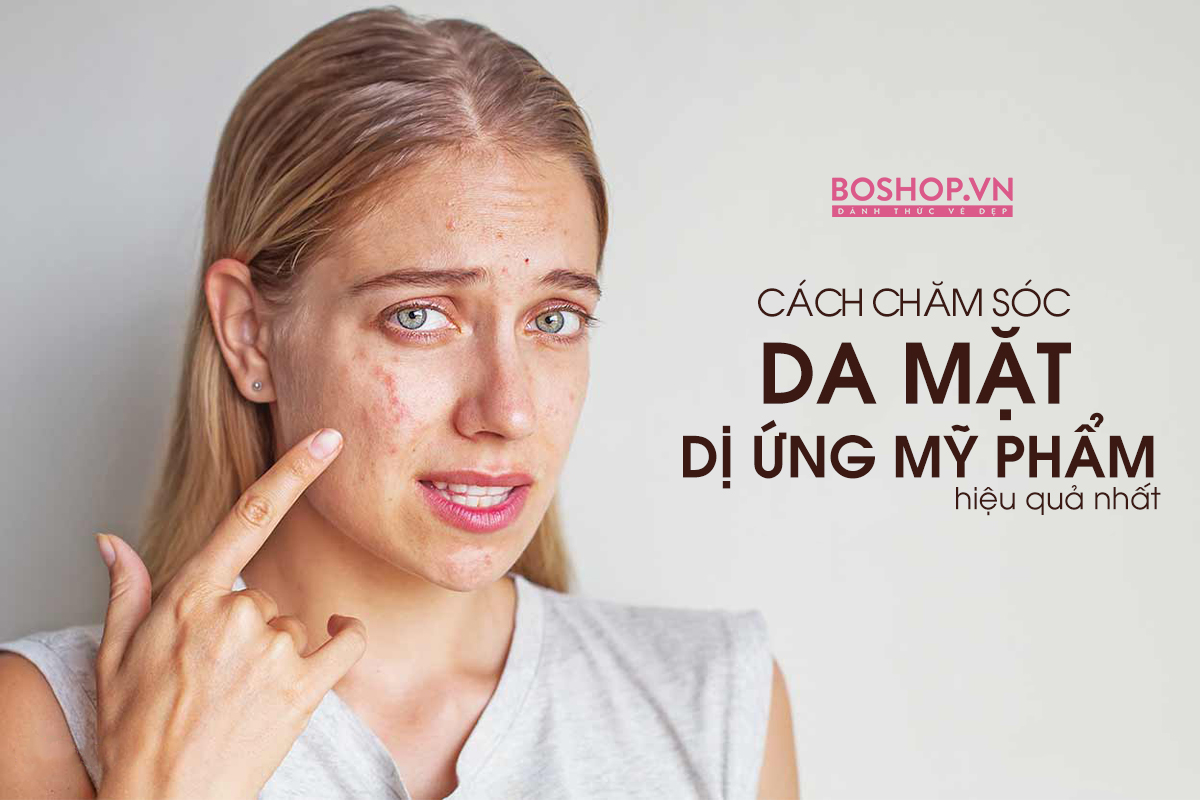 Cách chữa da mặt bị dị ứng mỹ phẩm tại nhà an toàn, hiệu quả