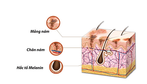 cach-chua-tri-nam-chan-sau-gay-nhieu-kho-khan-hon-nam-mang-jpg