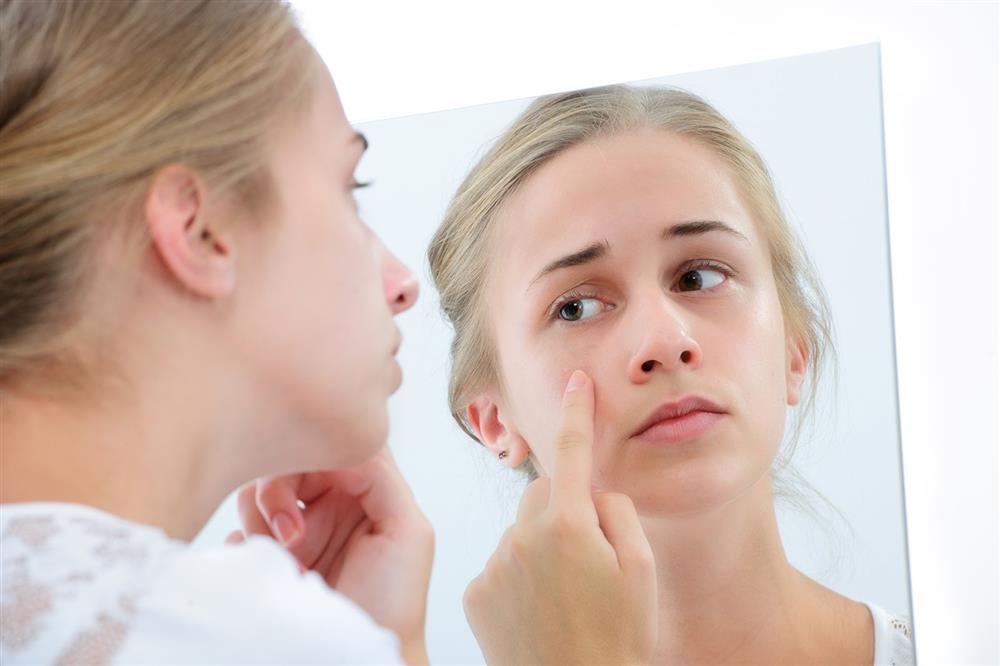 hoc-ngay-cach-nhan-biet-da-bi-di-ung-va-day-mun-khi-dung-aha-bha-retinoids-1-jpg