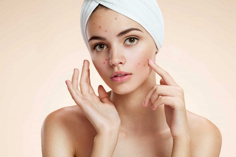 hoc-ngay-cach-nhan-biet-da-bi-di-ung-va-day-mun-khi-dung-aha-bha-retinoids-13-jpg