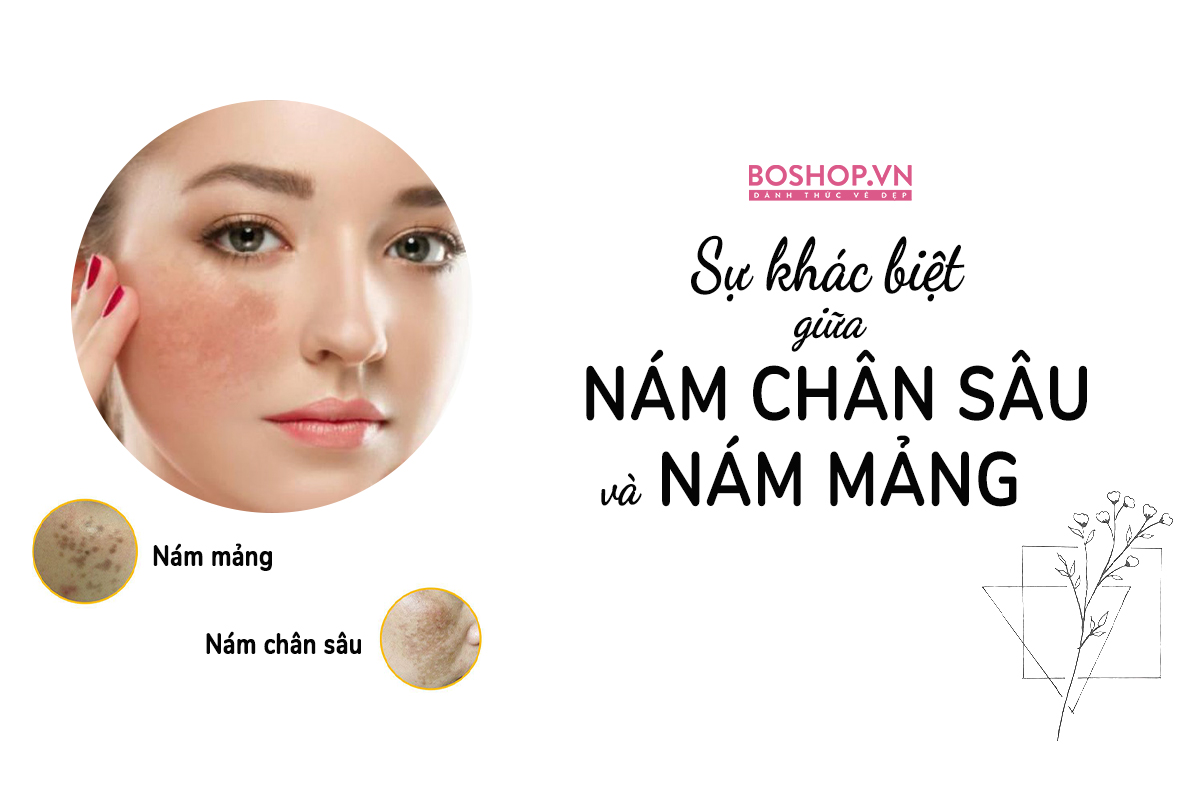 nhan-biet-nam-chan-sau-va-nam-mang-de-co-cach-dieu-tri-hieu-qua-tai-nha-jpg