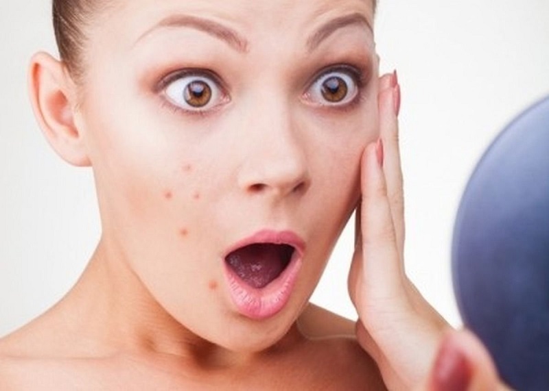 hoc-ngay-cach-nhan-biet-da-bi-di-ung-va-day-mun-khi-dung-aha-bha-retinoids-18-jpg