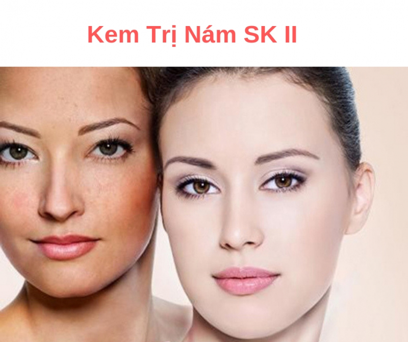 kem-tri-nam-sk-ii-whitening-source-derm-brightener-giai-phap-cham-soc-lan-da-nam-hieu-qua-ngay-tai-nha-jpg