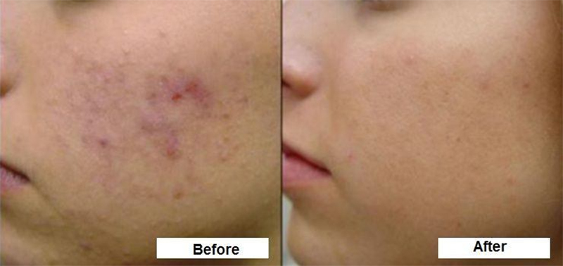 kham-pha-su-that-my-pham-neutrogena-co-that-su-tot-nhu-loi-don-boshop-4-jpg
