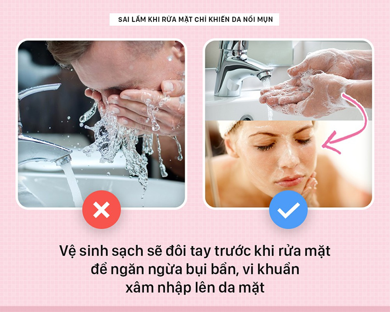 bi-quyet-dieu-tri-mun-mu-sung-do-o-mat-ma-nang-nen-biet-boshop-9-jpg