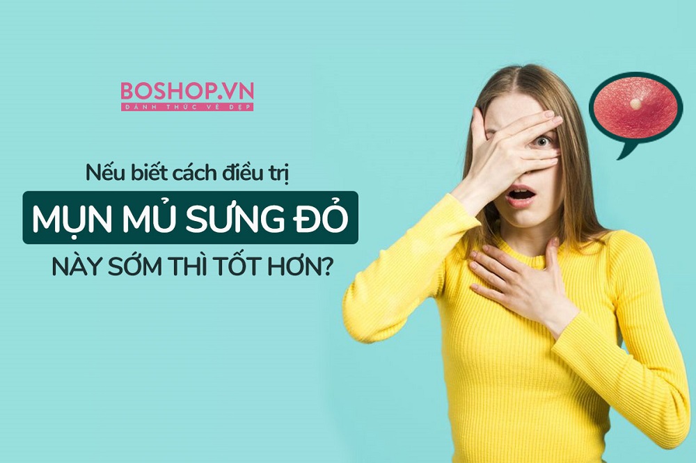 neu-biet-cach-dieu-tri-mun-mu-sung-do-o-mat-nay-som-thi-tot-hon-jpg