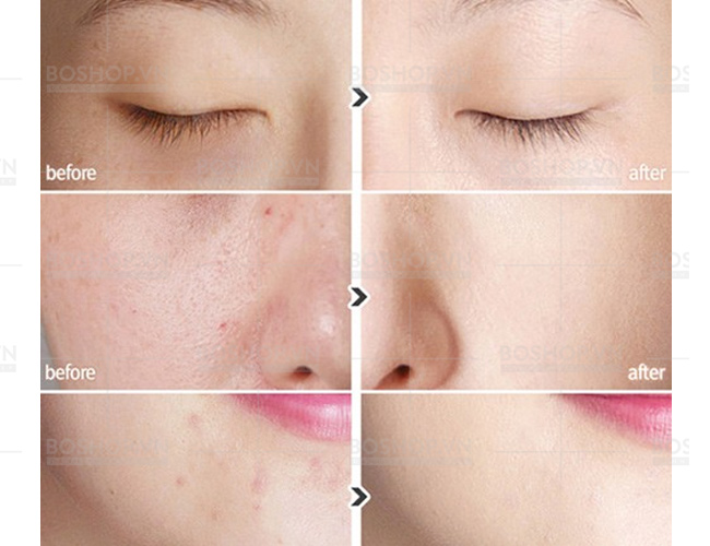 kem-nen-chong-nang-the-face-shop-bb-cream-giup-ban-che-di-nhieu-khuyet-diem-jpg