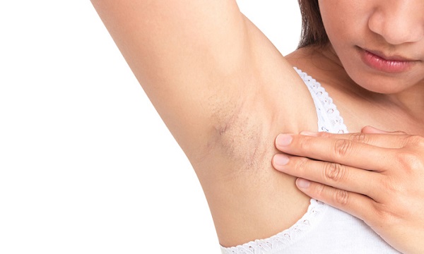 beauty-tips-bi-quyet-lam-sang-vung-tham-duoi-canh-tay-jpg