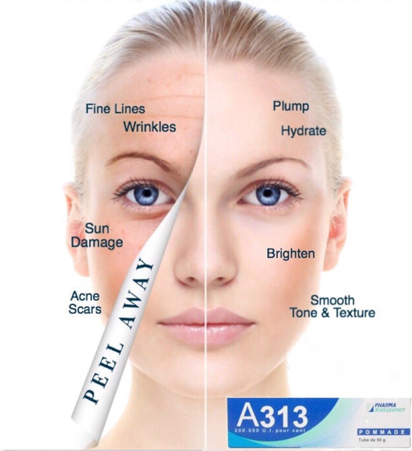 review-retinol-a313-pommade-vitamin-a-boshop-6-jpg