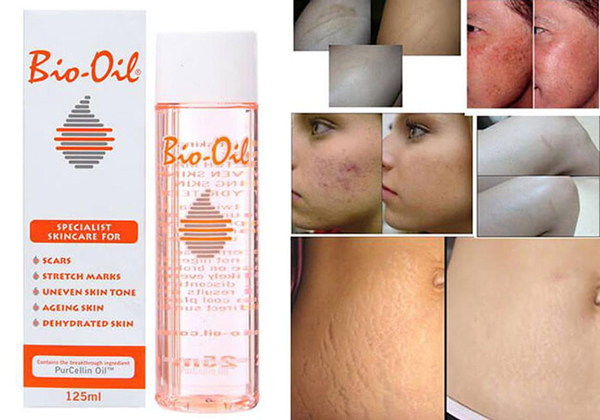 review-bio-oil-tri-ran-da-boshop-1-jpg