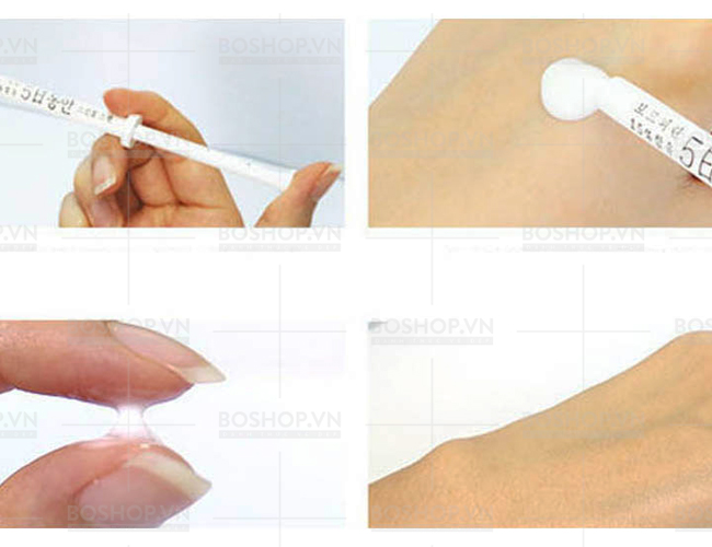 huyet-thanh-tre-hoa-da-5-day-dongan-wrinkle-filler-1-5ml-boshop-7-jpg