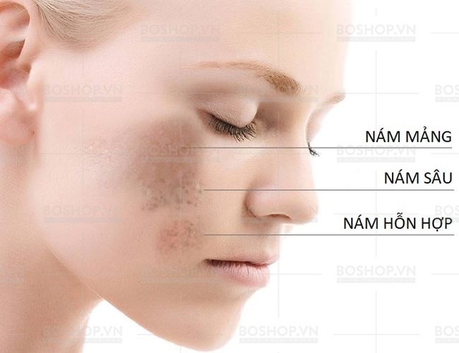 tri-tham-nam-tan-nhang-melloderm-hq-4-hydroquinone-7g-boshop-8-jpg