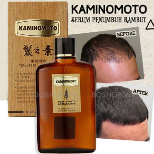 tinh-dau-duong-va-kich-thich-moc-toc-kaminomoto-150ml-boshop-7-jpg