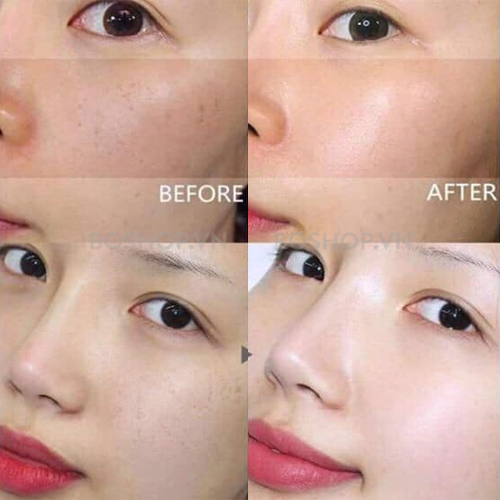 tinh-chat-duong-tri-tham-nam-rohto-melano-cc-premium-20ml-beforeafter-boshop-jpg