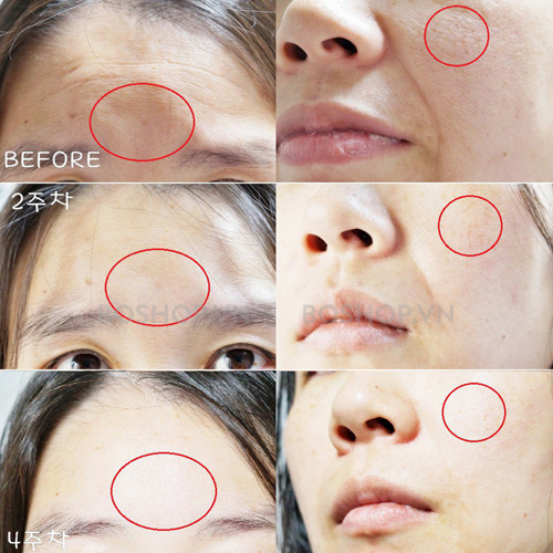 tinh-chat-trang-da-chong-lao-hoa-esthepro-vitamin-c-serum-561-50ml-boshop-9-jpg