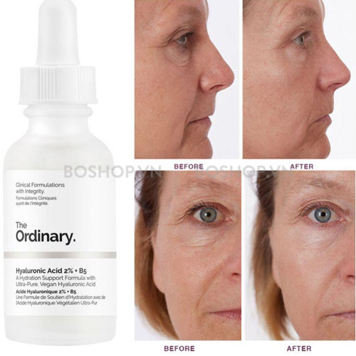 Tinh chất The Ordinary Hyaluronic Acid 2% + B5 