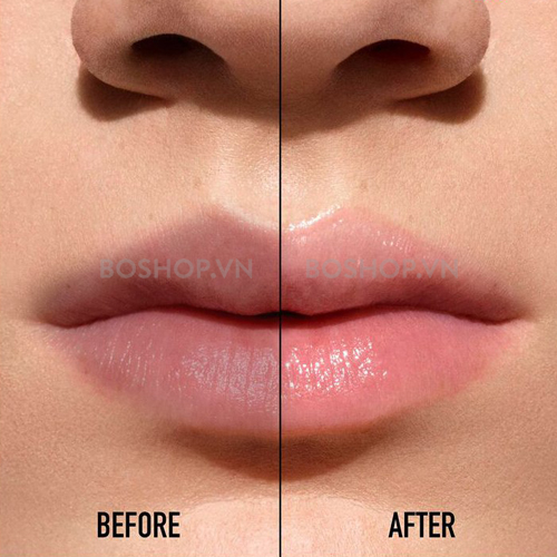 gel-duong-am-lam-hong-moi-mediheal-labocare-pantenolips-healssence-10ml-boshop6-jpg