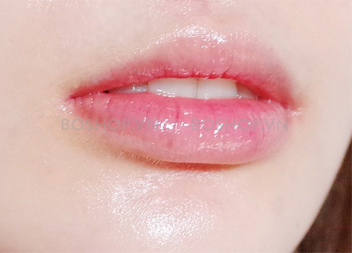 gel-duong-am-lam-hong-moi-mediheal-labocare-pantenolips-healssence-10ml-boshop4-jpg