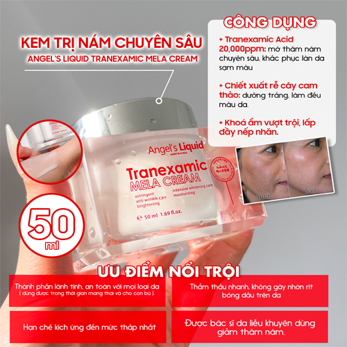 kem-duong-mo-nam-chuyen-sau-angels-liquid-tranexamic-mela-cream-50ml-boshop-3-jpg