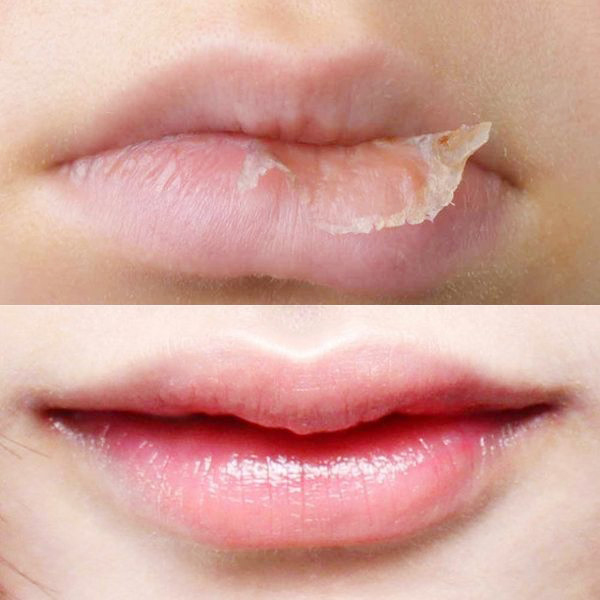 son-duong-khong-mau-tri-tham-moi-dhc-medicated-lip-cream-boshop-4-jpg