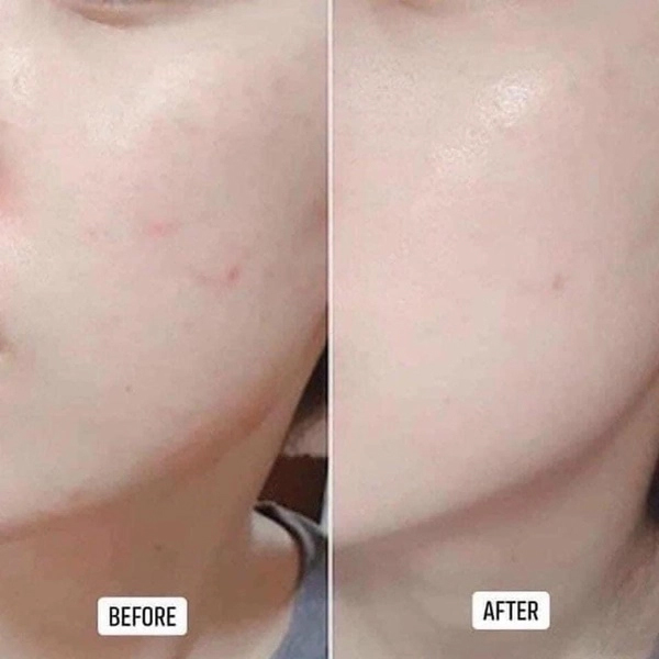 gel-rua-mat-cho-da-dau-mun-nhay-cam-svr-sebiaclear-gel-moussant-boshop-8-jpg