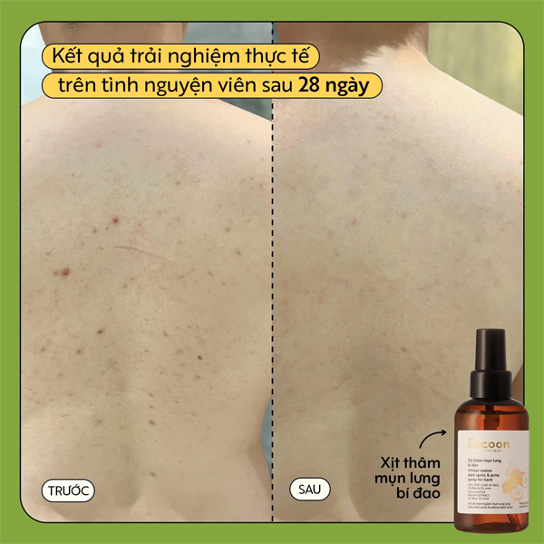xit-tham-mun-lung-bi-dao-cocoon-winter-melon-dark-spots-acne-spray-140ml-boshop-8-jpg