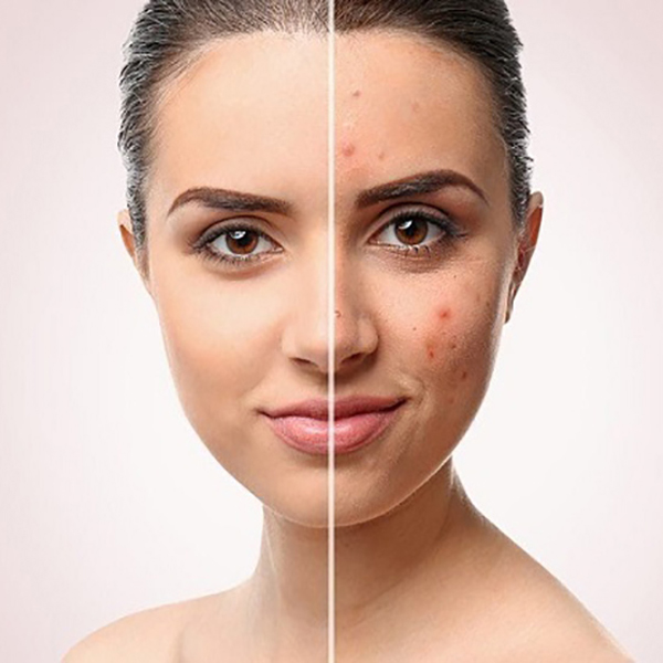 su-dung-retinol-sao-cho-dung-boshop-10-jpg