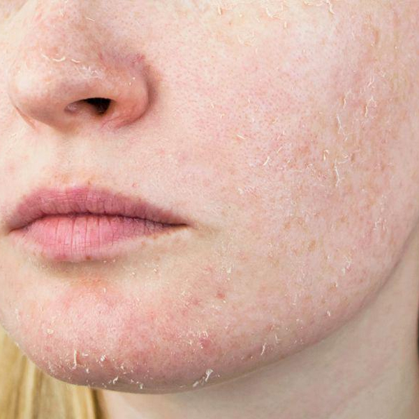 su-dung-retinol-sao-cho-dung-boshop-18-jpg