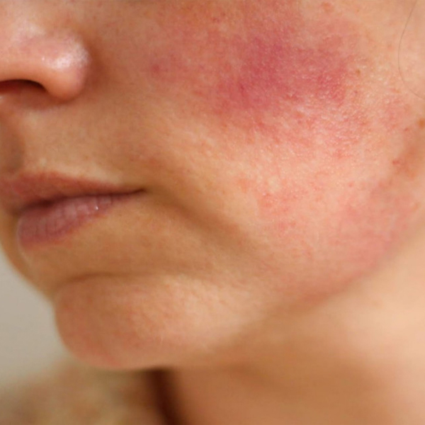 su-dung-retinol-sao-cho-dung-boshop-19-jpg