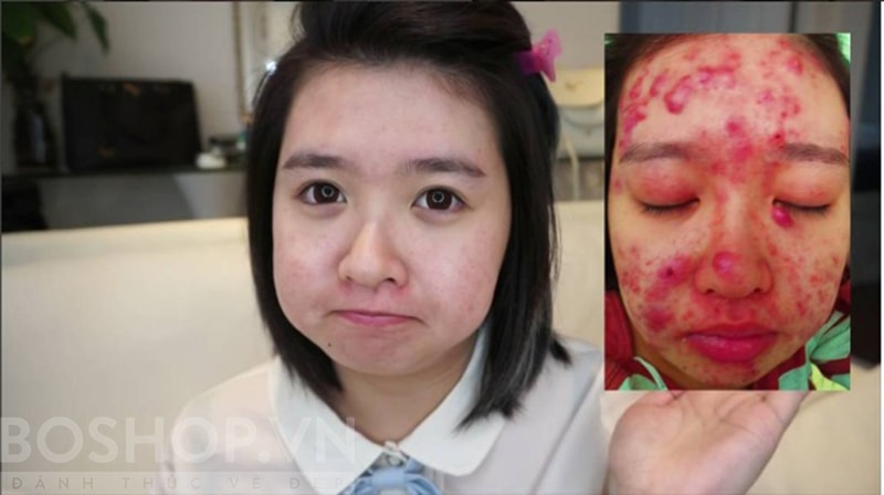 Elaine Mokk là nhân vật đã được nhắc đến tại đây