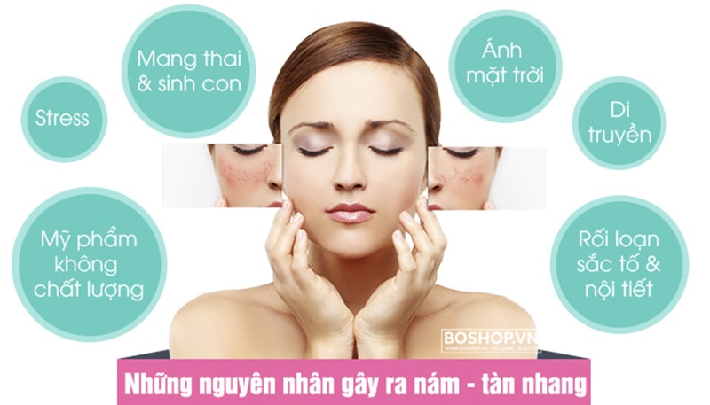 Nám da cách nhận biết và phương pháp điều trị